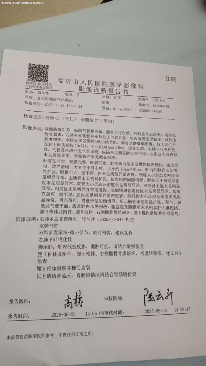 肺鳞癌骨转移
